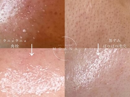 モアナ(MOANA)の写真