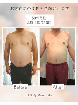 アンドユー(&U)/