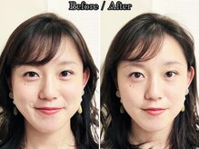アオヤマ サロン ワイゼット(AOYAMA SALON YZ)の雰囲気（大切な日に向けて、むくみ・左右差を整え、すっきり小顔へ）