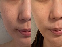 ひっそり美肌構築の雰囲気（お肌のキメが細かくなり、健やかで透明感のあるお肌へ）