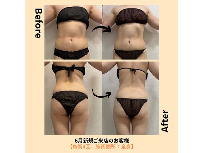 エラ(Ella)の写真