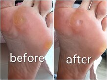 ビソク(VISOK)の雰囲気（ハンドケアとフットケア専門のマシーンを併用/角質ケア/魚の目）