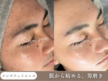 ムーンサン(Moon sun)の写真/清潔感と好印象をつくるメンズフェイシャル&眉毛ケア!都度払いOK/勧誘なし"高品質×低価格"で通いやすさ◎