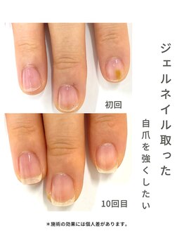 最強ネイルケア