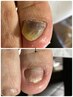 【分厚い爪・変形爪2回目以降】継続的なネイルケアが必須¥3300～
