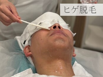 ケリーズ(KELLY `S)/ヒゲ脱毛/全身脱毛/VIO脱毛