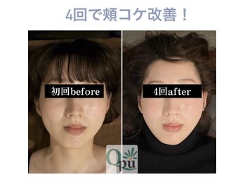 キュープ 鹿児島伊集院店(Qpu)/