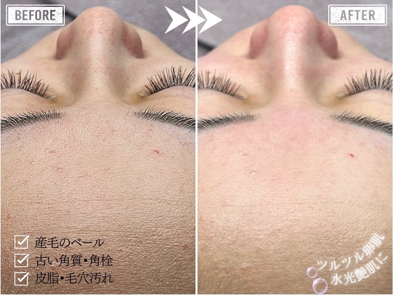 ホワイトワックス 難波店(WHITE WAX)｜ホットペッパービューティー