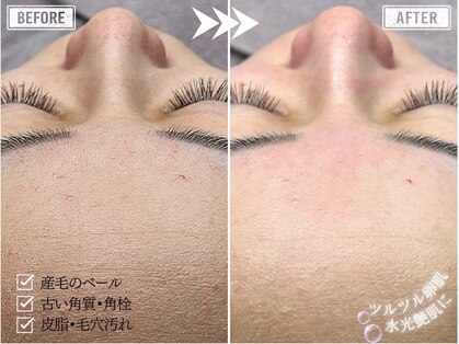 ホワイトワックス 難波店(WHITE WAX)の写真