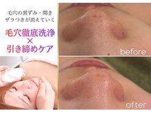 パッチ バイ サロンデヤンス(Patch by SALON DE YANSU)