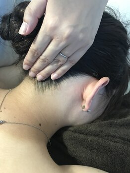 ハロ(Halo)/襟足脱毛