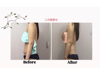 エス(es)/二の腕集中アプローチ