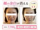 シアワセ(shiAwase)の写真