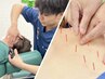 【人気No,2】眼精疲労集中全身整体&鍼灸 90分　11880円→6600円