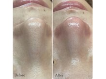 ピエル 北千住店(PIEL)/継続は力なり