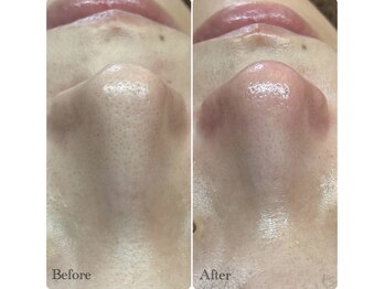 ピエル 北千住店(PIEL)/継続は力なり