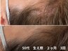 温泉・濡れても怖くない！髪の悩みの第一歩♪育てるヘアケア13200→初回体験