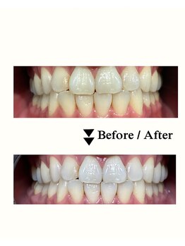 ラポ(Lapo)/歯科衛生士在籍サロン！