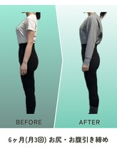 縁/ビフォーアフター