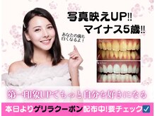 ホワイトニングショップ 多摩店