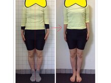 ローズ ド ナチュール(Rose de Nature)の雰囲気（美容整骨矯正　身体　経過写真）