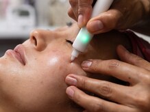 ピンポイントでシミ改善★