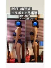 デール(R:DeeL)/１ヶ月でボディラインが変わった
