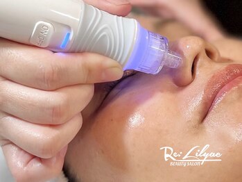 リリアック(Re:Lilyac)/Re:ilyac#毛穴洗浄#フェイシャル