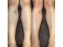 メンズ エステティック ヒーロー(men's esthetic HERO)の雰囲気（エチケットとして脱毛する方増！Waxはツルツルの状態で帰宅可能）