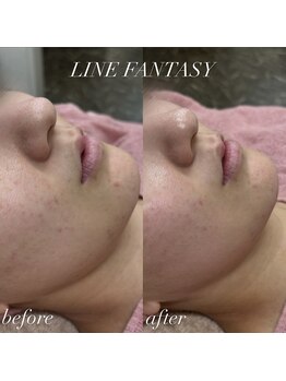 ラインファンタジー 武庫之荘店/【クリスティーナビオフィート】