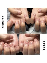 リミズネイルビューティー 名駅店(RimisNailxbeauty)/【美爪育成】深爪・噛み爪改善