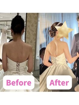 ボディキュア ブライダル美容整体 大阪梅田/【肋骨締め】くびれをゲット★