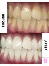 エクシアホワイトニング 王寺店/