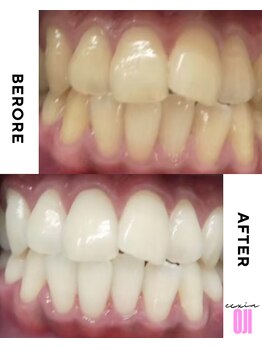 エクシアホワイトニング 王寺店/