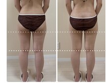 リミュール(Ri.miyuru)/首肩リンパマッサージで他も整う