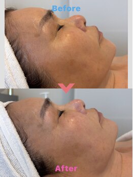 モンドレーヴ(mondereve)/