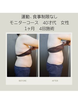 キセキ KISEKI リラクゼーション/最強×最新マシンでダイエット