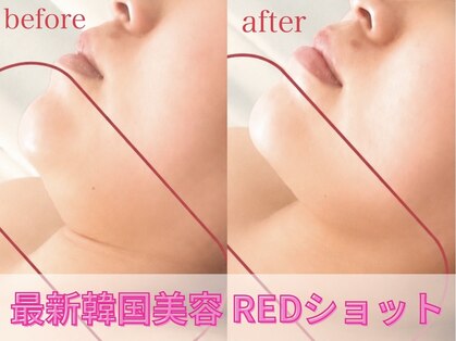 エンズ 米野木店(0's)の写真