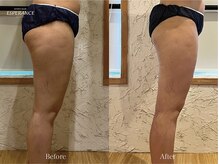 エステティックサロン エスぺランス(ESPERANCE)/太腿,ヒップ周りのセルケアも！