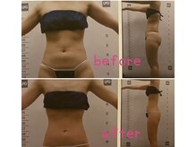 ビューティースパ/便の悩み解消！ポッコリお腹改善