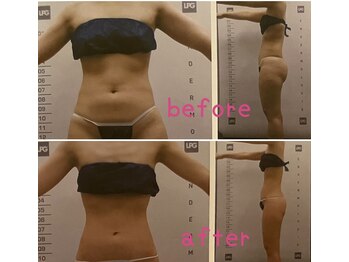 ビューティースパ/便の悩み解消！ポッコリお腹改善