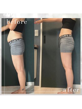 ヨサパーク デイジー(YOSA PARK Daisy)/痩身/ダイエット/リンパ/毛穴