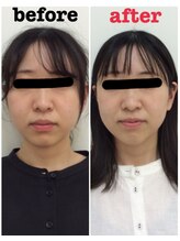 健スマ整骨院 大津院/頭痛の改善にもおすすめです♪