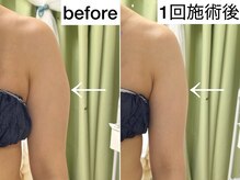 サロンリー(Salon Riee)の雰囲気（むくみやセル脂肪をなくして引き締まった身体に☆  三郷中央）