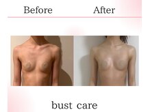 サロンツキ(salon tuki)/バストアップ/バストケア症例