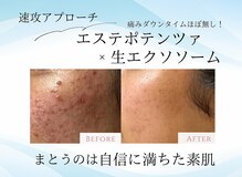 エイミー(Aimee)