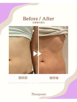 ピエルポゼ(Piereposer)/しっかりほぐしてスッキリ!