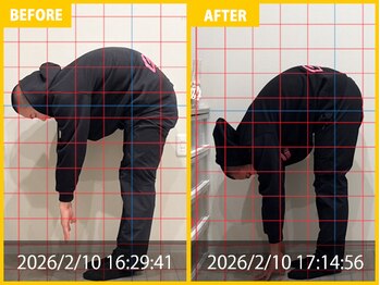 整体院 元 くまなん店/10代男性 練習で肩と足の痛み