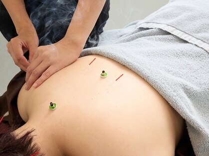 Re:treat HARi 大阪梅田院【鍼灸/ヘッドスパ/オイルマッサージ】【リトリートハリ】の写真