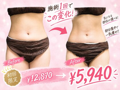 おにぎり(ONIGIRI)の写真